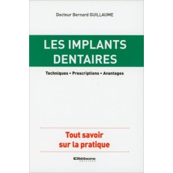Les implants dentaires - Techniques - Prescriptions - Avantages