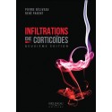 Infiltrations de corticoïdes