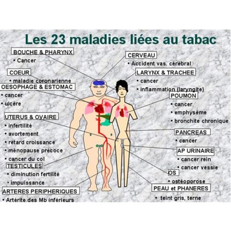 SEVRAGE TABAC MONTPELLIER SEVRAGE TABAC MONTPELLIER